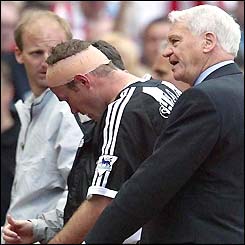 Alan Shearer leaves the field injured