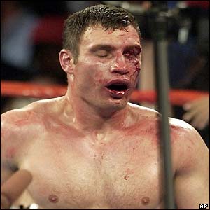 Vitali Klitschko after his defeat by Lennox Lewis in Los Angeles