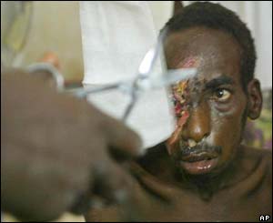 Treatment in a makeshift hospital, Bunia
