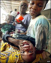 Edwin Kopo, one, lies on his mothers lap