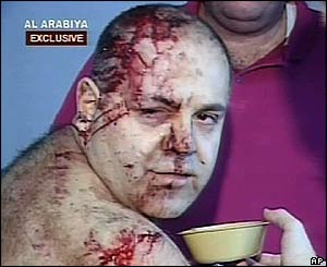 Television shows one of the injured being treated in hospital 