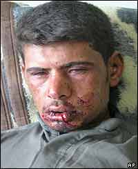 An injured Iraqi man