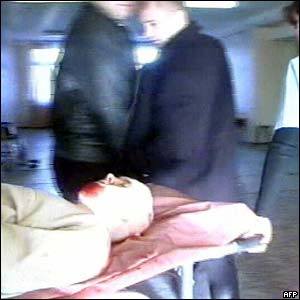 Injured passenger from the suicide bombing of a commuter train 