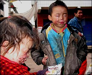 Injured children