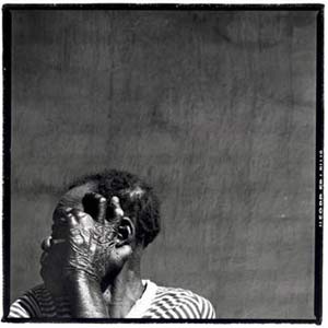 Manuel Dashauki at the Mutemwa Leprosy Settlement (Photograph by Simon Roberts)