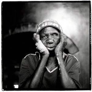 Veronica Rambi at the Mutemwa Leprosy Settlement (Photograph by Simon Roberts)