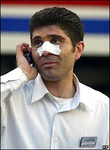 Injured man near the village of Tavsancil, in north-west Turkey