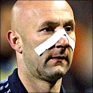 Marseille's on-loan keeper Fabien Barthez sports a bandage after a blow in the face