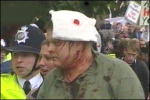 A protester with a head wound