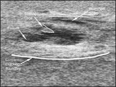 Satellite images of the nuclear test site 