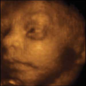 27 weeks gestation. 24cm crown to rump.