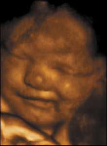 34 weeks gestation. 34cm from crown to rump.