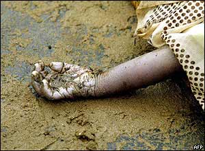 Hand of a dead child in Galle, Sri Lanka