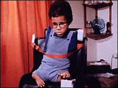 Thalidomide survivor