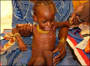 Crying child, Niger