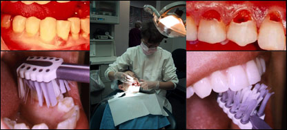 د غاښ ناروغ او ډاکټر