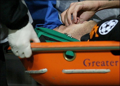 آلبرتو آکیلانی