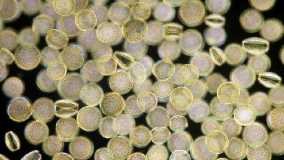 Conscinodiscus concinnus