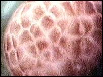 Um único embrião pode ser formado a partir de dois óvulos e dois espermatozóides diferentes