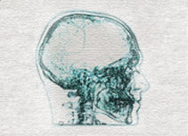 Side-on xray of skull