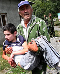 مجروحان اوستیای جنوبی 