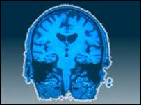 انسانی دماغ