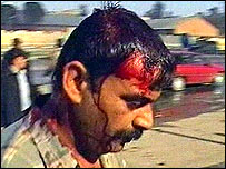 Musul'daki saldırıda yaralanan bir Iraklı