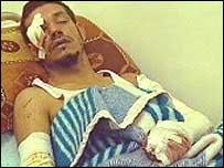 Sobrevivente iraquiano do tiroteio com tropas dos EUA