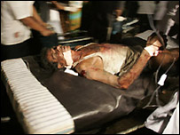 Injured passenger taken into Kalubovila hospital (AP photo)