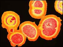 variante da bactéria MRSA 