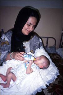 کودک مبتلا به سوء تغذی 