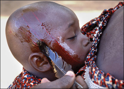 A child with bleeding scarification cuts.