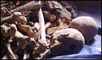 bones from the Rwandan genocide