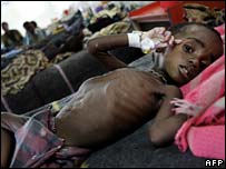 کودک گرسنه مانده در مالاوی