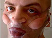 Korzet na obličeji - kosmetický zákrok