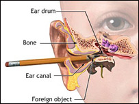 په غوږ کې پنسل وهل