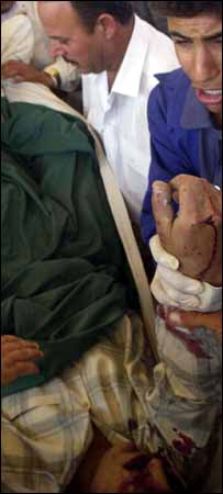 Ferido em choques com os EUA em Mosul é levado a hospital em Talafar