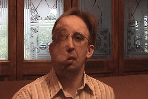 Other people's attitudes can make life quite challenging when you look different.