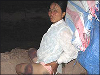 Một nữ công nhân tham gia đình công ở huyện Việt Yên, Bắc Giang bị thương, 05.08 (nguoi-viet.com)