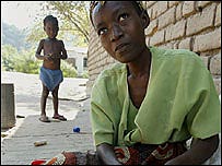 Criança infectada com o vírus da AIDS em Malawi, na África. 