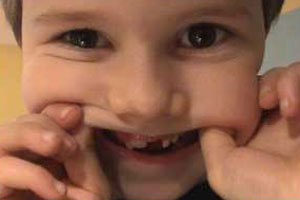 Matthew has lost a tooth