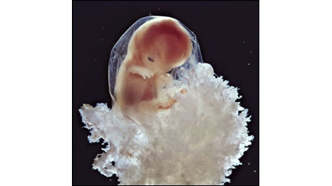 10 semanas (Fotos: Lennart Nilsson)