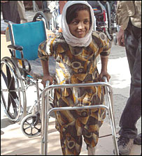 معيوبه زده کوونکی