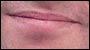 Lips