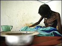 अफ्रीका में कुपोषण का शिकार एक व्यक्ति