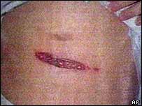 Çen Şui Bien saldırıdan 11 santimlik bir sıyrıkla kurtuldu