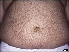 Số người béo phì trên toàn thế giới ngày càng tăng