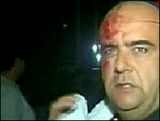 Lesionado por el terremoto en Viña del Mar