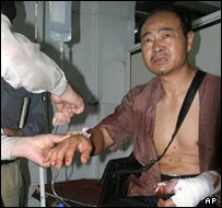 مرد چینی زخمی