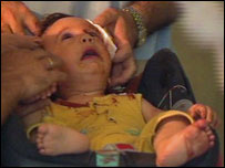 Một em bé bị bắn ở bên ngoài Gori, thị trấn lớn nhất ở khu giáp với Nam Ossetia